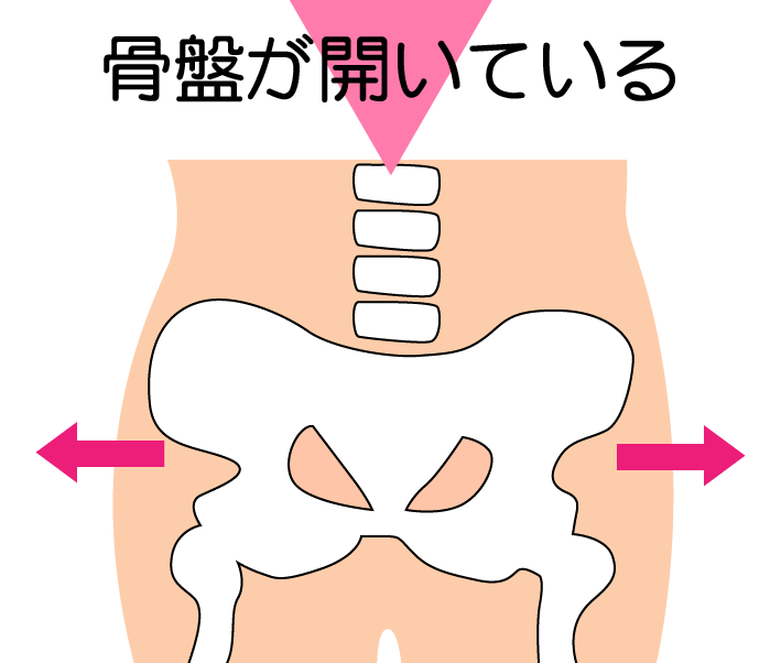 骨盤が開いている