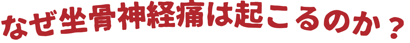 なぜ坐骨神経痛は起こるのか？