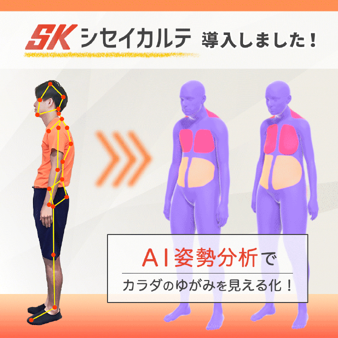 姿勢のスコア化